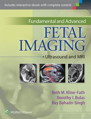 Diagnostic Imaging of Fetal Anomalies