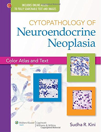 Cytopathology of Neuroendocrine Neoplasia