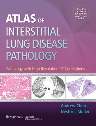 Atlas of Interstitial Lung Disease Pathology: Pathology With High Resolution CT Correlations