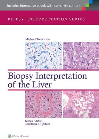 Biopsy Interpretation of the Liver