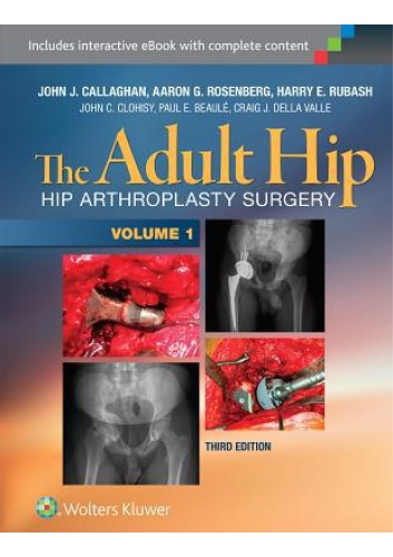 The Adult Hip (Two Volume Set)