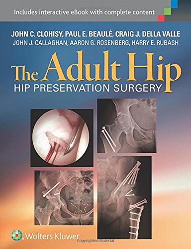 Hip Preservation Surgery