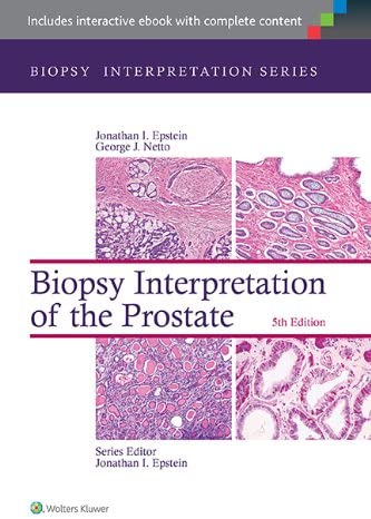 Biopsy Interpretation of the Prostate