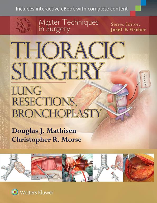 Master Techniques in Surgery
