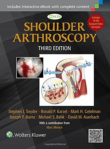 Shoulder Arthroscopy