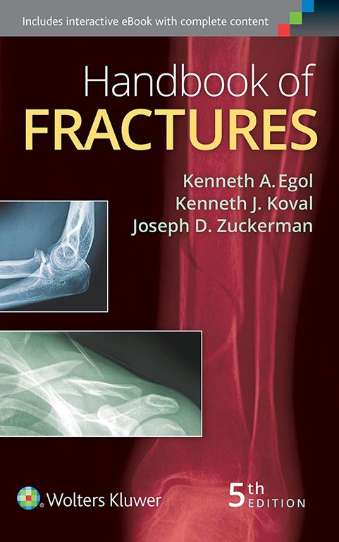 Handbook of Fractures