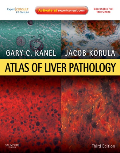 Atlas of Liver Pathology E-Book