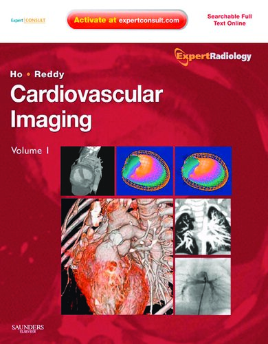 Cardiovascular Imaging E-Book