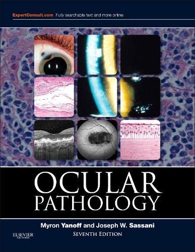 Ocular Pathology