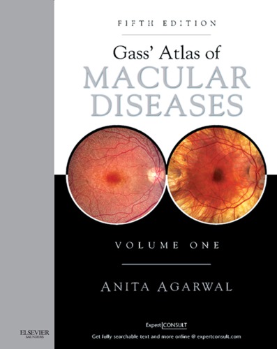 Gass' Atlas of Macular Diseases E-Book