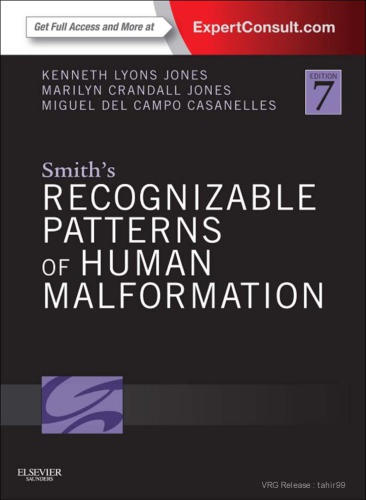 Smith's Recognizable Patterns of Human Malformation