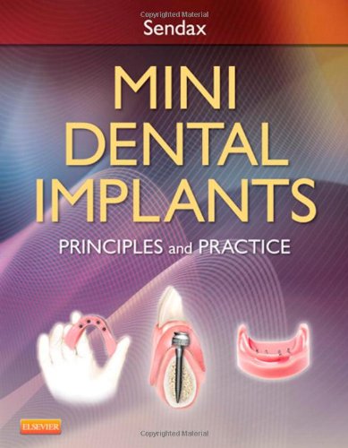 Mini Dental Implants