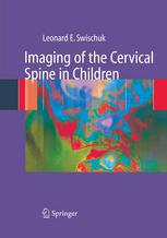 Imaging of the Cervical Spine in Children