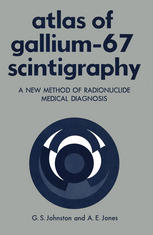 Atlas of Gallium-67 Scintigraphy : a New Method of Radionuclide Medical Diagnosis.