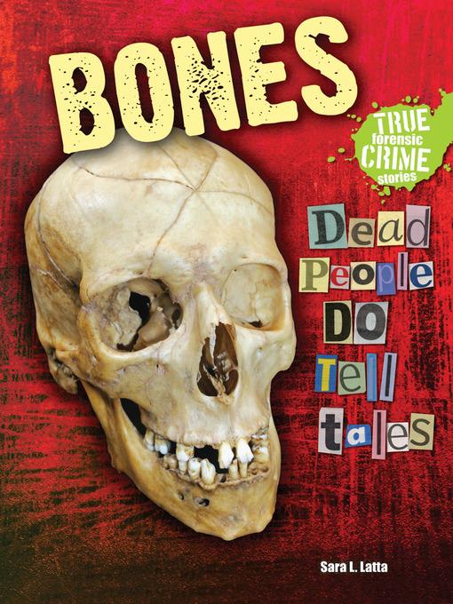 Bones