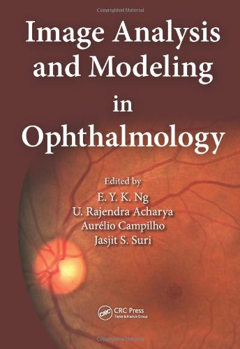 Image Analysis and Modeling in Ophthalmology