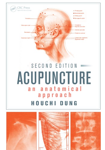 Acupuncture