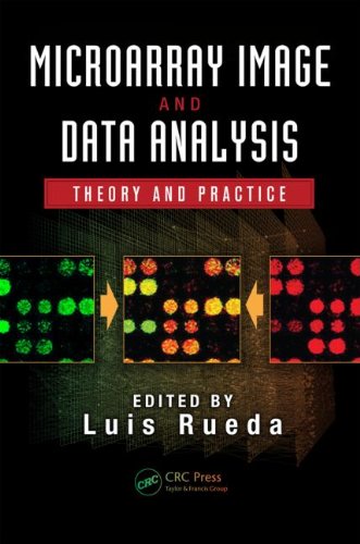 Microarray Image and Data Analysis