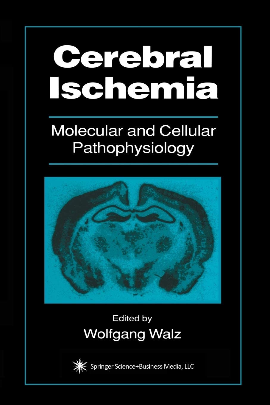 Cerebral Ischemia: Molecular and Cellular Pathophysiology (Contemporary Neuroscience)