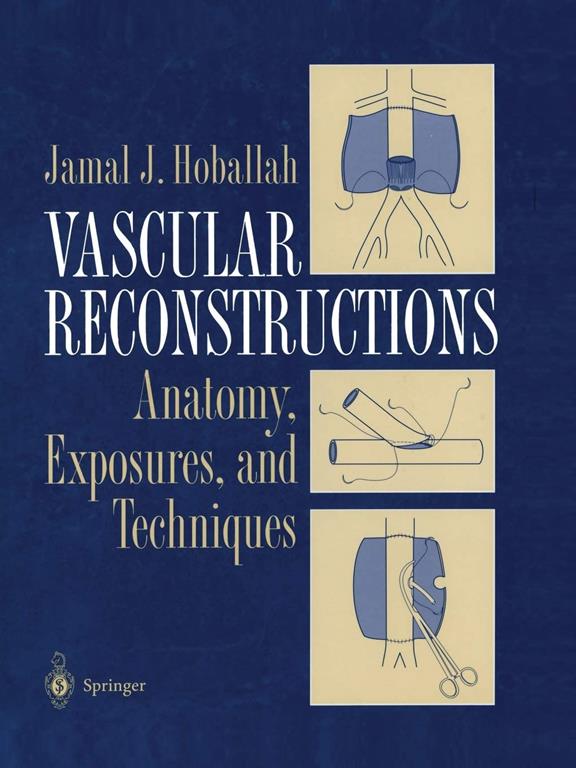 Vascular Reconstructions: Anatomy, Exposures and Techniques