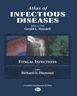 Atlas of Infectious Diseases : Fungal Infections.