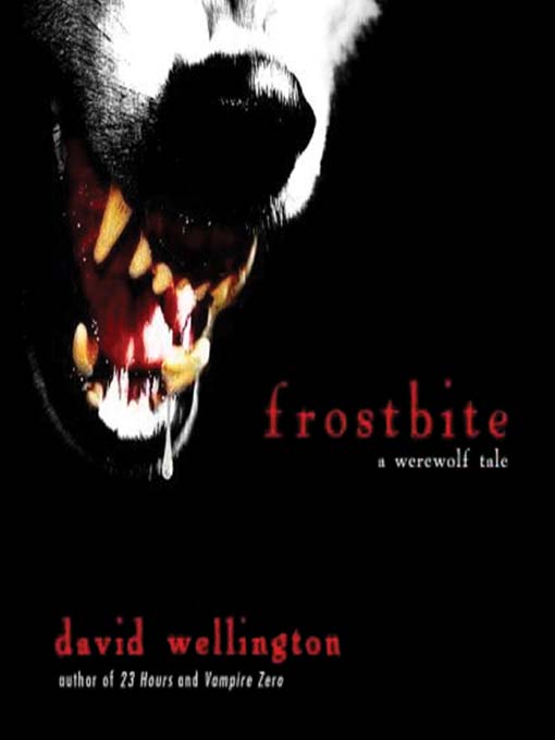 Frostbite
