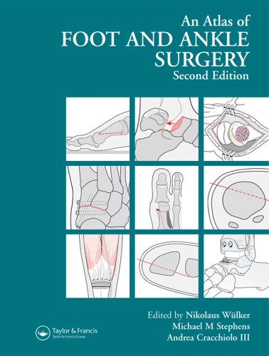 An atlas of foot and ankle surgery