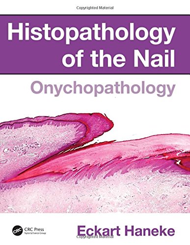 Histopathology of the Nail