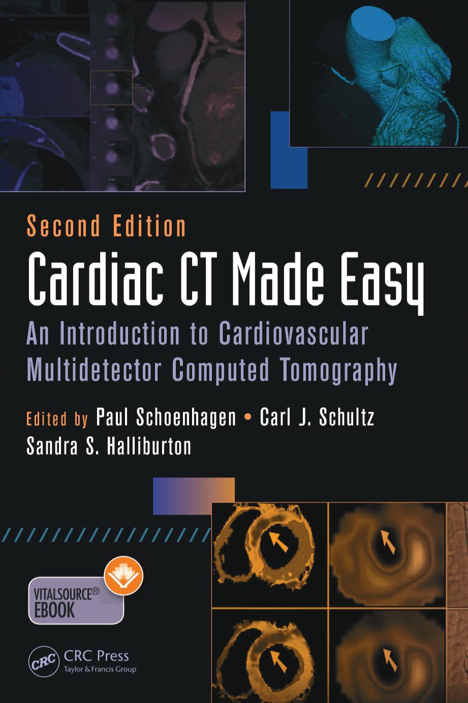 Cardiac CT made easy : an introduction to cardiovascular multidetector computed tomography