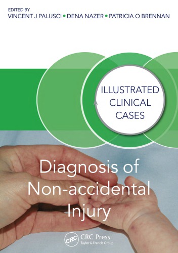 Diagnosis of Non-accidental Injury