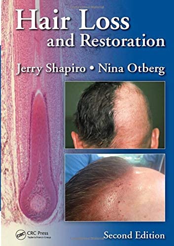 Hair Loss and Restoration, Second Edition