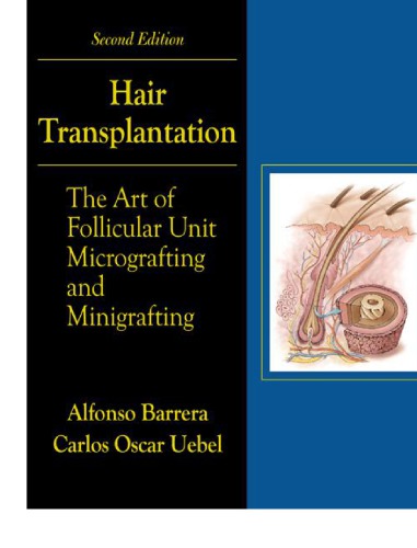 Hair transplantation : the art of follicular unit micrografting and minigrafting