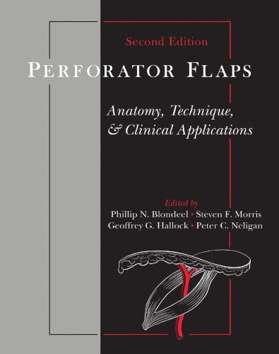 Perforator Flaps : Anatomy, Technique, & Clinical Applications, Second Edition.