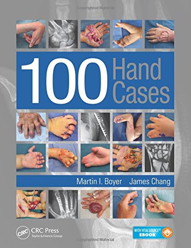 100 Hand Cases