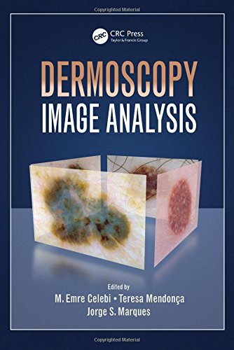 Dermoscopy image analysis