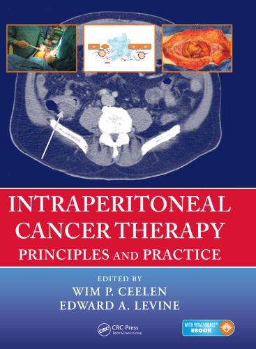 Intraperitoneal cancer therapy : principles and practice