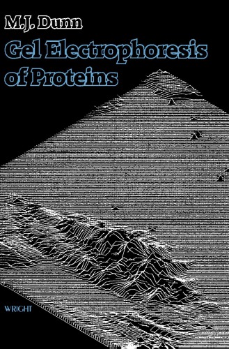 Gel Electrophoresis of Proteins.