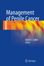 Management of Penile Cancer