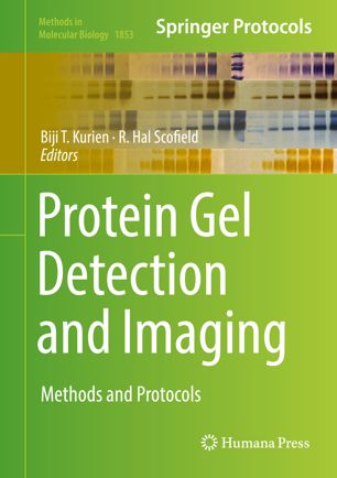 Protein Gel Detection and Imaging