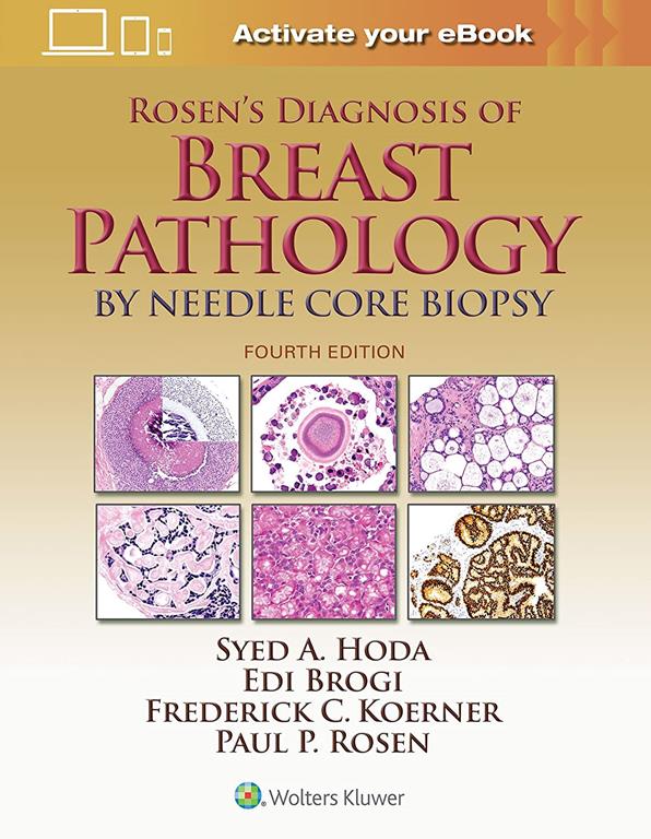 Rosen's Diagnosis of Breast Pathology by Needle Core Biopsy