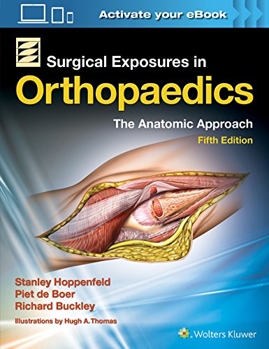 Surgical Exposures in Orthopaedics