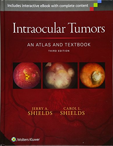 Intraocular Tumors