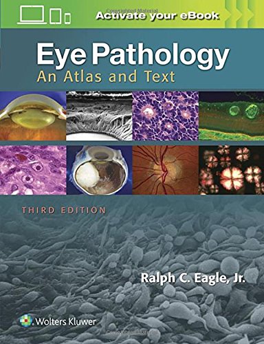 Eye Pathology