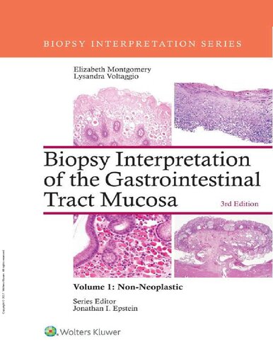 Biopsy Interpretation of the Gastrointestinal Tract Mucosa