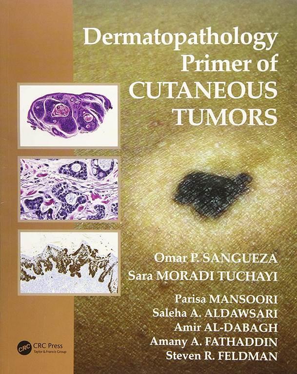 Dermatopathology Primer of Cutaneous Tumors