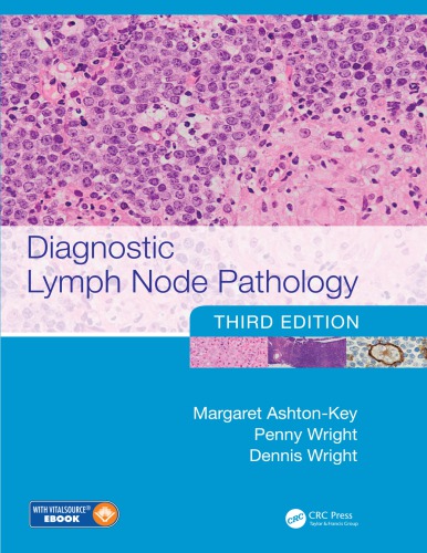 Diagnostic Lymph Node Pathology