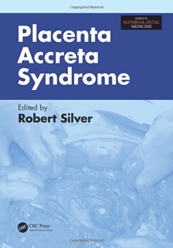 Placenta Accreta Syndrome