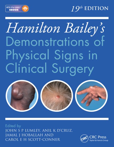 Hamilton Bailey's Physical Signs