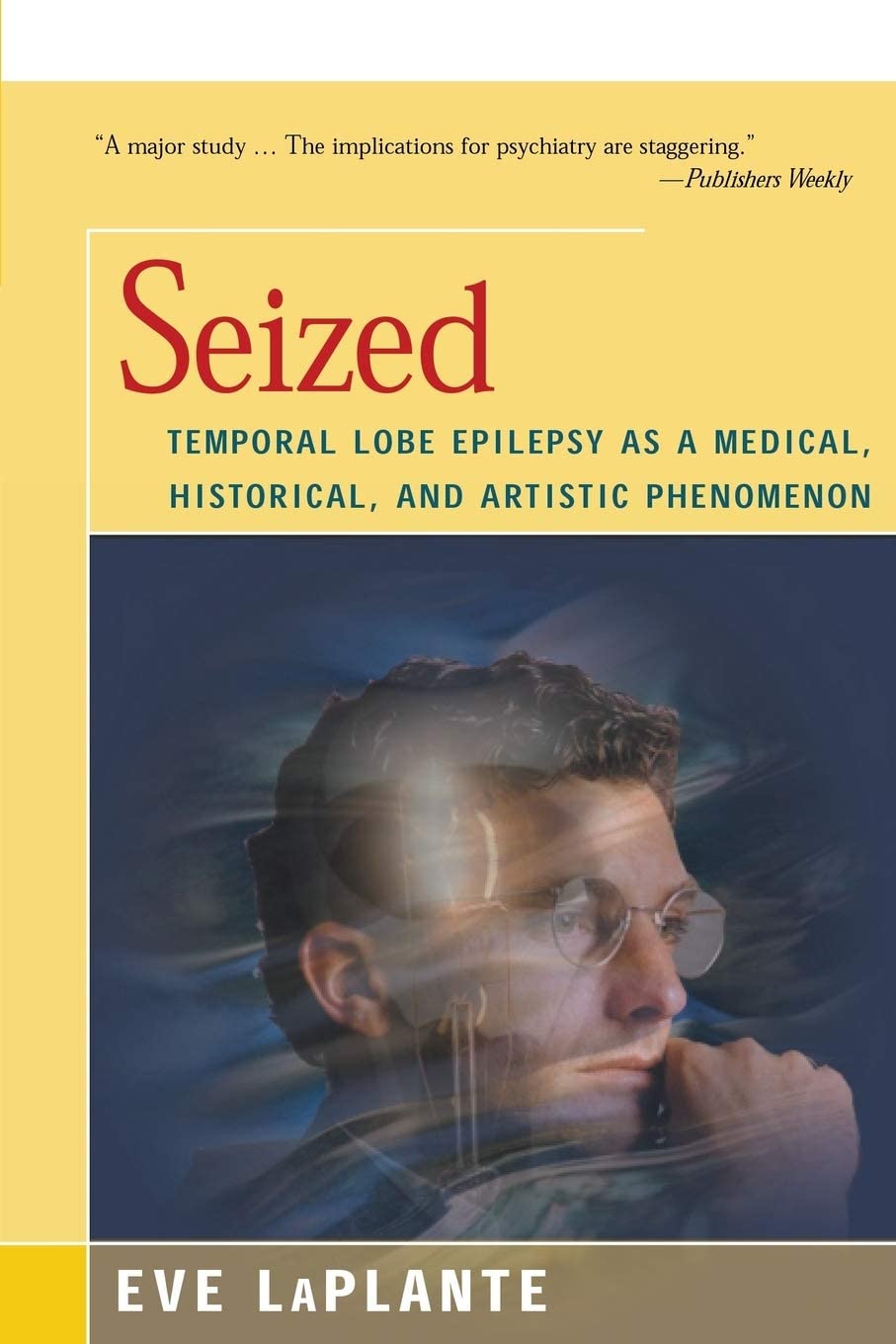 Seized: Temporal Lobe Epilepsy as a Medical, Historical, and Artistic Phenomenon