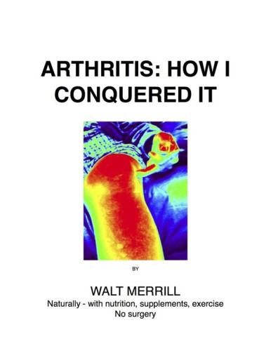 Arthritis